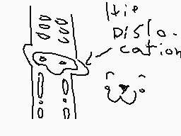 Drawn comment by TreeSapp😠😔
"tip dislocation"